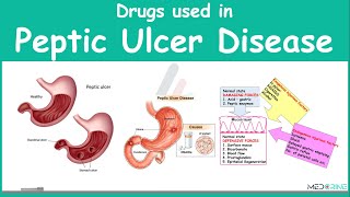 Drugs Used in Treament of Peptic Ulcer Diseae Pharmacology [upl. by Anayt]