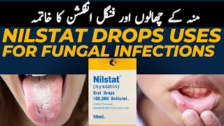 Nilstat drops Uses and side effects  Antifungal Drops For Mouth Infection [upl. by Opiuuk]