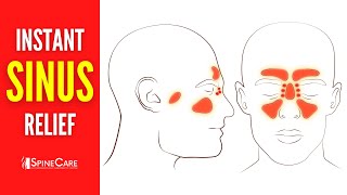 How to Relieve Sinus Congestion in 30 SECONDS [upl. by Bram]