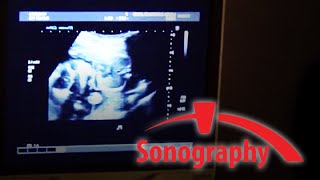 SONO – Sonography  BRCC [upl. by Joice587]