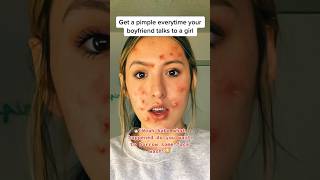 pov you get a pimple everytime he talks to a girl 🔴 viralshorts [upl. by Sharity]