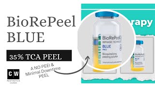 BioRePeel a 35 TCA Peel for Aestheticians Safe all year for all skin types [upl. by Korney906]