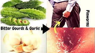 Watch How Bitter Gourds and Garlic Remedies Can Be Used to Get Rid of Pinworms [upl. by Nho]