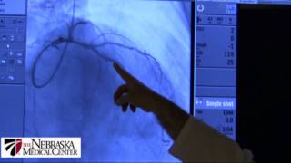 Coronary Stents  The Nebraska Medical Center [upl. by Uno]