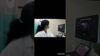 early pregnancy scan single live intrauterine pregnancy pregnancy [upl. by Lehcsreh]