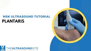 Musculoskeletal ultrasound tutorial  Plantaris [upl. by Bussy]