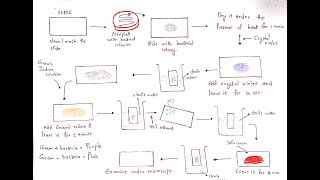 Gram Positive vs Gram Negative Bacteria  Differences Gram Staining Method Examples [upl. by Krefetz]