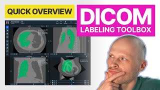 DICOM annotation toolbox  quick overview [upl. by Goar246]