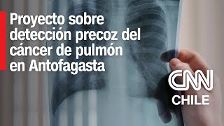 Antofagasta Nuevo proyecto busca detectar precozmente el cáncer de pulmón [upl. by Shaun]