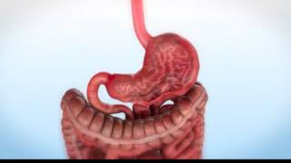 Endoscopic Sleeve Gastroplasty ESG Animation [upl. by Paulsen]