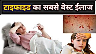 टाइफाइड बुखार का बेस्ट ईलाज  Typhoid fever treatment  S Typhi  best medicine [upl. by Carmon]