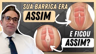 Tive DIÁSTASE ABDOMINAL e agora [upl. by Bradwell]