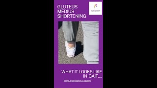 Gluteus Medius shortening in gait podiatry chiropractic gait glutes physiotherapy [upl. by Eitsim800]