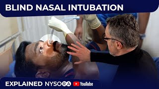 Blind Nasal SelfIntubation  Crash course with Dr Hadzic [upl. by Htiel347]