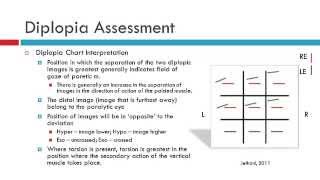 Diplopia [upl. by Dustin62]