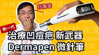 治凹痘疤，新武器 Dermapen 得美微針筆，第四代微針筆，治療凹痘疤快速又方便！ [upl. by Horowitz]