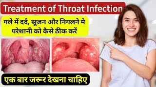 Pharyngitis throat infection treatment in hindi  गले में खराश दर्द और सूजन होने पर क्या करें [upl. by Sirraj560]