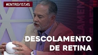 Tudo o que você precisa saber sobre o descolamento de retina [upl. by Akirderf]