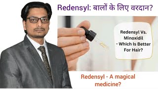 Redensyl vs Minoxidil in treatment of Androgenetic Alopecia Redensyl की उपयोगिता गंजापन के इलाज में [upl. by Deny]