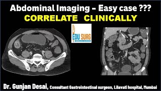 Mastering Abdominal Imaging CT Scan Interpretation Tips  Correlate clinically  Edusurg Clinics [upl. by Lleksah]