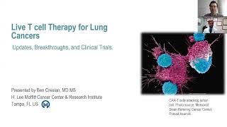 Conférence du CRCHUM  Cell therapy the next pillar of lung cancer treatment [upl. by Wagshul]