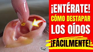 ¿OIDOS TAPADOS👂Mira Como Destapar Los Oidos Con estos 3 Remedios Caseros [upl. by Tsugua787]