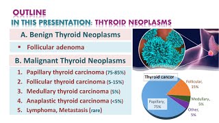 Thyroid neoplasmsTumors  شرح محاضرة [upl. by Badger]