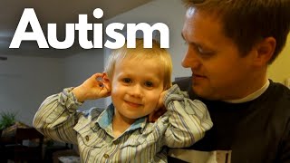 12 Signs of Autism in a 2yearold [upl. by Napier]