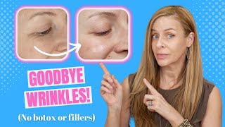 ELIMINATE Wrinkles amp Crows Feet In Minutes Per Day  No Botox Fillers  Nira At Home Laser Review [upl. by Konstance]