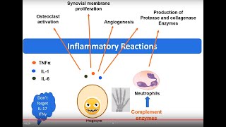 Rheumatoid Arthritis pathology in 5 minutes [upl. by Ced]