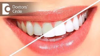 Teeth cleaning vs teeth whitening  Dr Sumanth M Shetty [upl. by Zuliram]