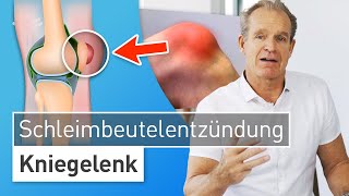 Knie angeschwollen und gerötet Das hilft bei Schleimbeutelentzündung am Knie  Dr Stefan Preis [upl. by Warford]