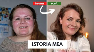 Metodele prin care am slăbit cu 60 de kilograme  Istoria mea [upl. by Kondon891]