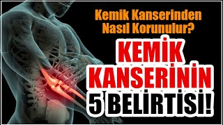 Kemik kanserinin 5 belirtisi Kemik tümörü nedir kemik kanseri belirtileri nelerdir [upl. by Sergeant735]