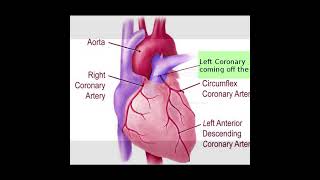 Anomalous Coronary Artery  Symptoms and Causes  Diagnosis  Treatment healthcare heartattack [upl. by Kathie]