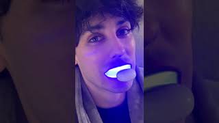 Auraglow is the BEST way to whiten your teeth this summer [upl. by Hamner]