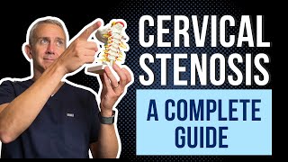 Cervical Spine Stenosis  A Complete Guide [upl. by Aicirtam913]