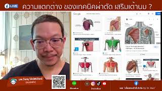 FB LIVE ความแตกต่างของเทคนิคเสริมหน้าอกแต่ละแบบ [upl. by Randene]