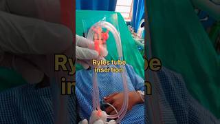 Ryles tube😱 insertion orNasogastric tube mbbs youtubeshorts viral shorts motivation doctor [upl. by Ariaic]