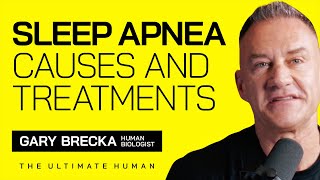 Sleep Apnea  Causes and Treatments with Gary Brecka [upl. by Vita]