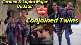 Viral Conjoined Twins Carmen amp Lupita Life Update Fascinating Story [upl. by Molli301]