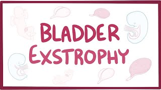 Bladder exstrophy  causes symptoms diagnosis treatment pathology [upl. by Airemat682]