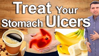 Do This And Cure Your Stomach Pain Gastritis and Ulcers  Best Natural Treatment of Stomach Pain [upl. by Yengac]