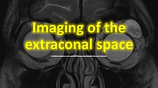 Imaging of the extraconal space [upl. by Nylecyoj83]