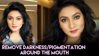 How To  Remove Darkness and Pigmentation Around The Mouth  Easy Home Remedies Ashtrixx [upl. by Mcnully]