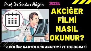 AKCİĞER FİLMİ NASIL OKUNUR 2 RADYOLOJİK ANATOMİ VE TOPOGRAFİSerdar Akgün Tıp Videoları [upl. by Selma]