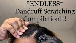 Scratching Dandruff Compilation  Picking Scabs on Scalp  Winter Itch Relief [upl. by Berke459]