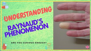 Raynauds Phenomenon  15 Things You Should Know [upl. by Eerolam]