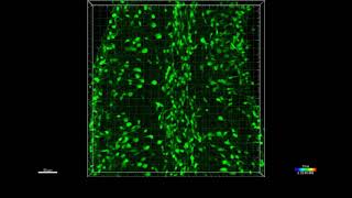 Migrating interneuron precursors in the cerebellum [upl. by Halonna]