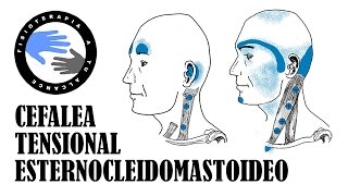 Dolor de cabeza masaje del musculo esternocleidomastoideo o ECM para la cefalea tensional [upl. by Akinom]